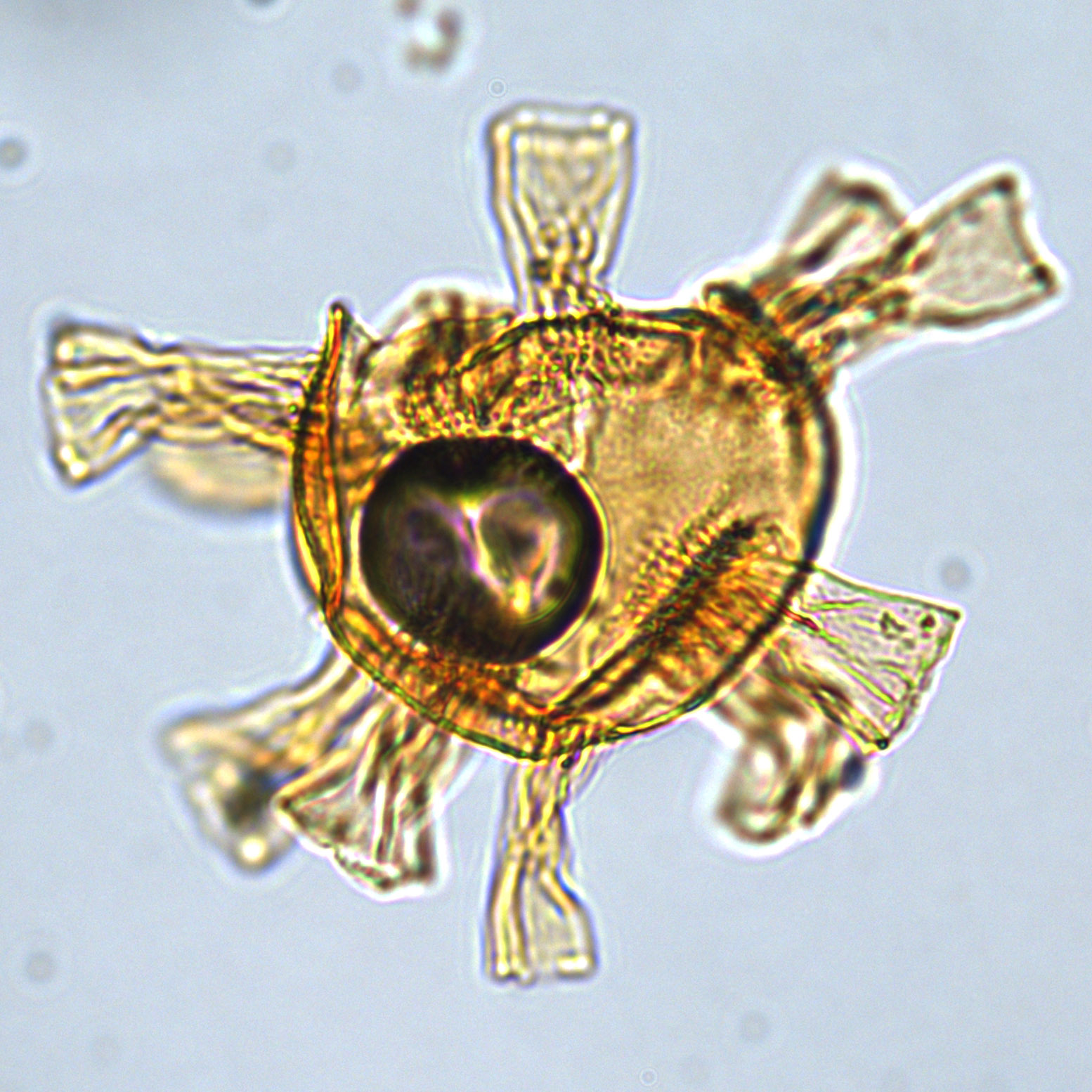 Oligosphaeridium totum, U1581-69R-CCW, 21-26, sl. 2, K52-3.jpg